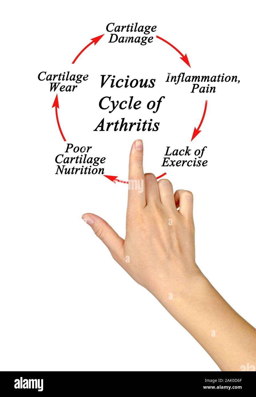 Steps in Vicious Cycle of Arthritis Stock Photo - Alamy