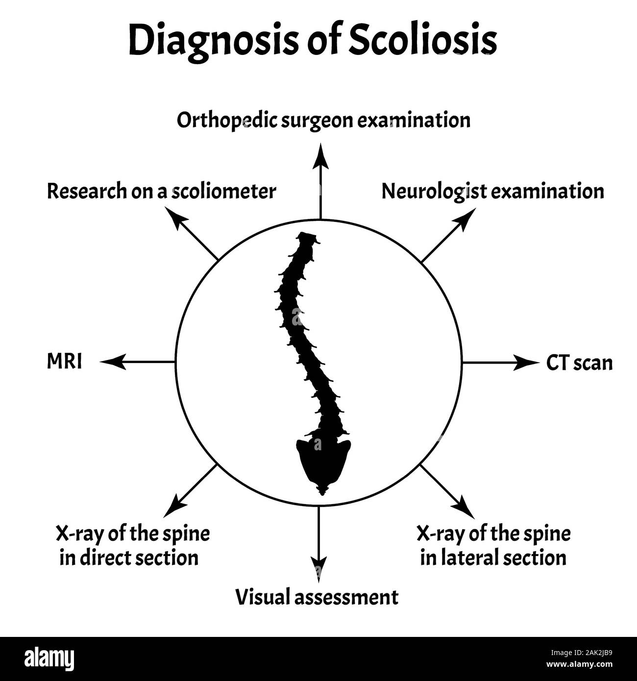 Diagnosis of Scoliosis. Spinal curvature, kyphosis, lordosis of the