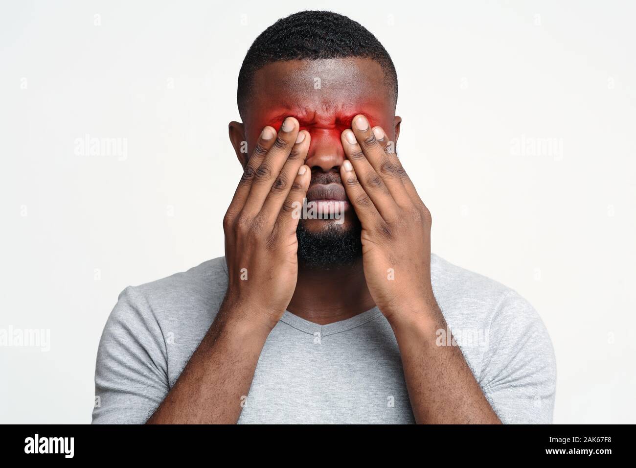 Overworked afro man rubbing eyes, suffering from eye pain Stock Photo