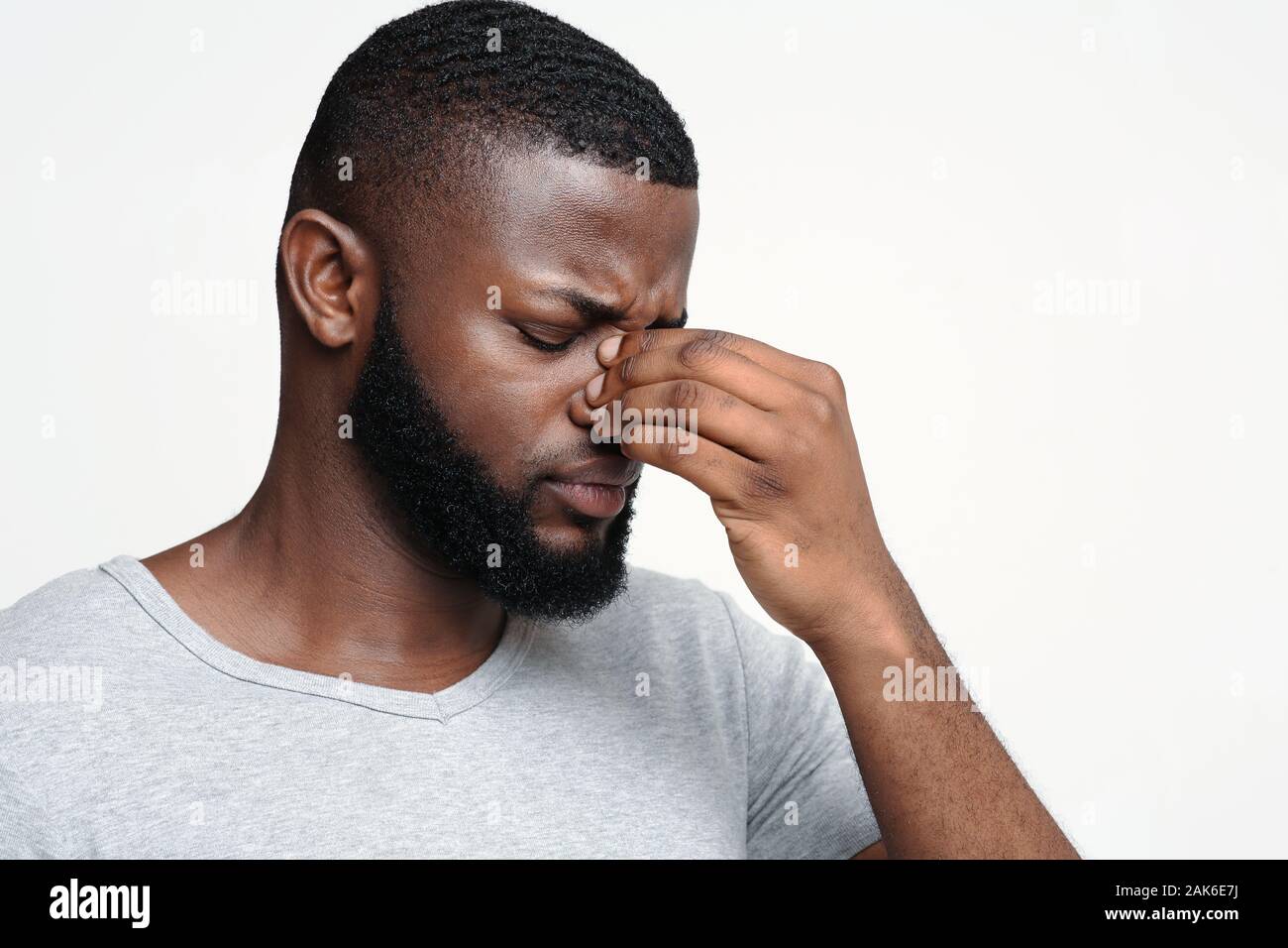 Tired Afro Man Touching His Nose Bridge Suffering From Eye Pain