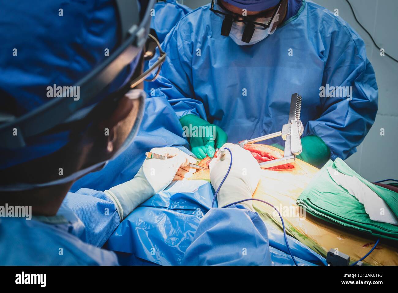 Minimal invasive surgery hi-res stock photography and images - Alamy