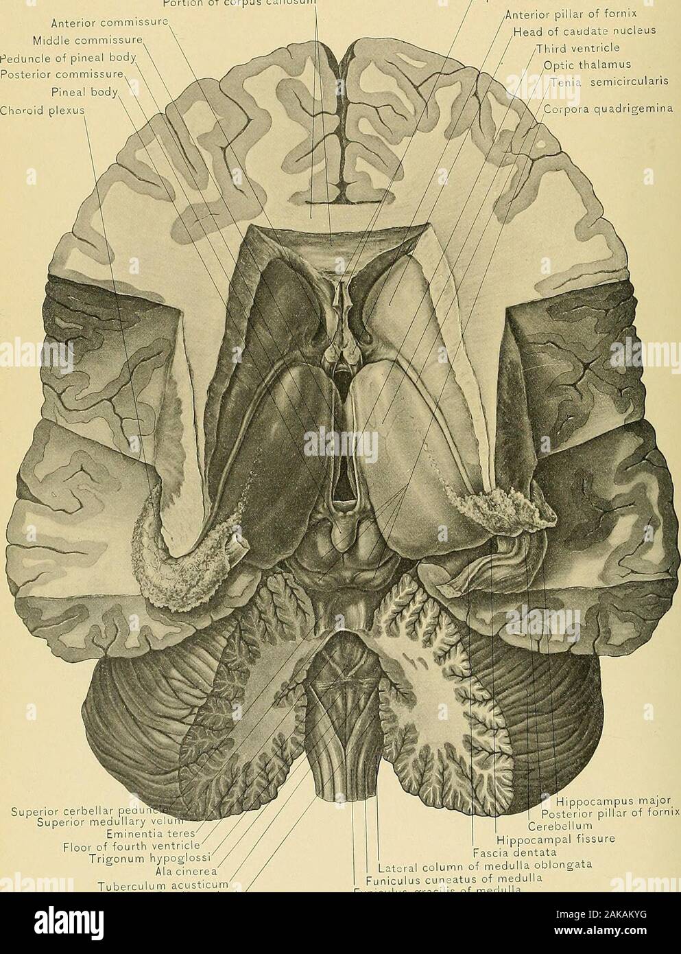 Surgical anatomy : a treatise on human anatomy in its application to the practice of medicine and surgery . Descending cornu of left lateral ventricle Velum interpositumBody of fornix(reFlected).yra VELUM INTERPOSITUM AND CHOROID PLEXUS,533 PLATE CCLXXXIII, Portion of corpus callosum Septum lucidum. Restiform body Lateral column of medulla oblongaFuniculus cuneatus of medullaFuniculus gracilis of medulla VENTRICLES AND NUCLEI OF THE BRAIN.536 THE INTERIOR OF THE CEREBRUM. b2,l of the pineal body ; in front, by tlie anterior commissure and tlie anterior pillarsof the fornix; and behind, by the Stock Photo