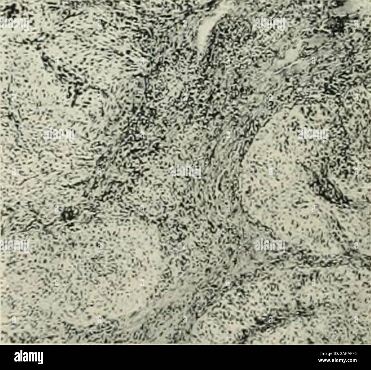 Gynecological diagnosis and pathology . Fig. 60.—Same in Section toshow