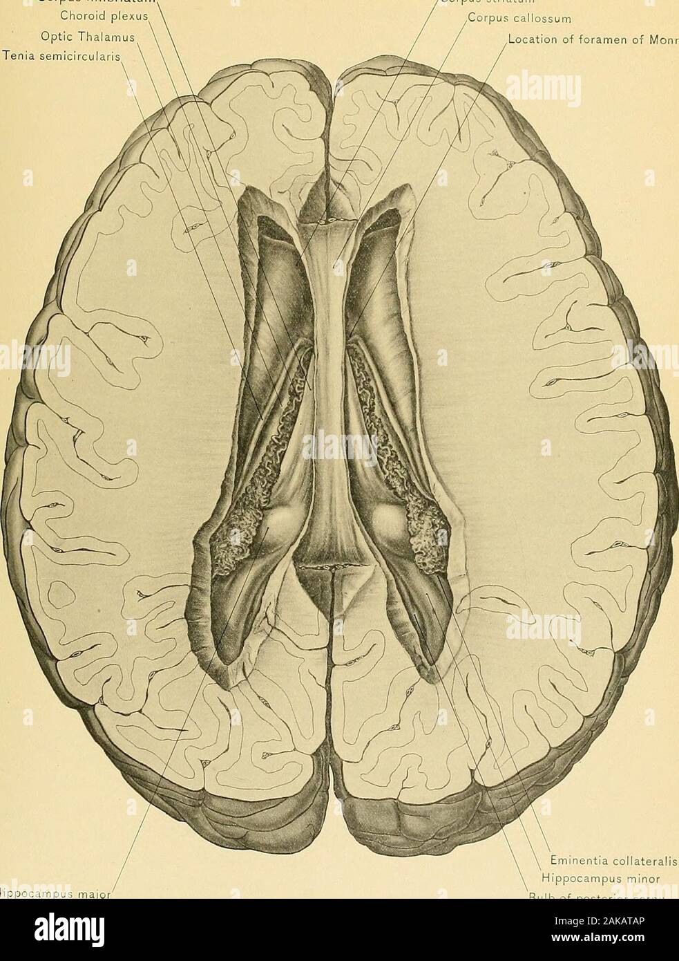Surgical Anatomy A Treatise On Human Anatomy In Its Application To The Practice Of Medicine And Surgery In Shape In A Coronal Section Its Antero Posterior Diameter Being The Longest And Its Transcribed image text from this question. https www alamy com surgical anatomy a treatise on human anatomy in its application to the practice of medicine and surgery in shape in a coronal sectionits antero posterior diameter being the longest and its vertical diameter theshortest it extends from the foramen of monro to the splenium of the corjjus cal losum it is bounded above by the corpus callosum internally by the posteriornarrow portion of the septum lucidum and the attachment of the corpus callosumto the fornix and externally by the merging angle formed by the corpus cal losum and the white substance of the hemisphere its floor is for image338914094 html