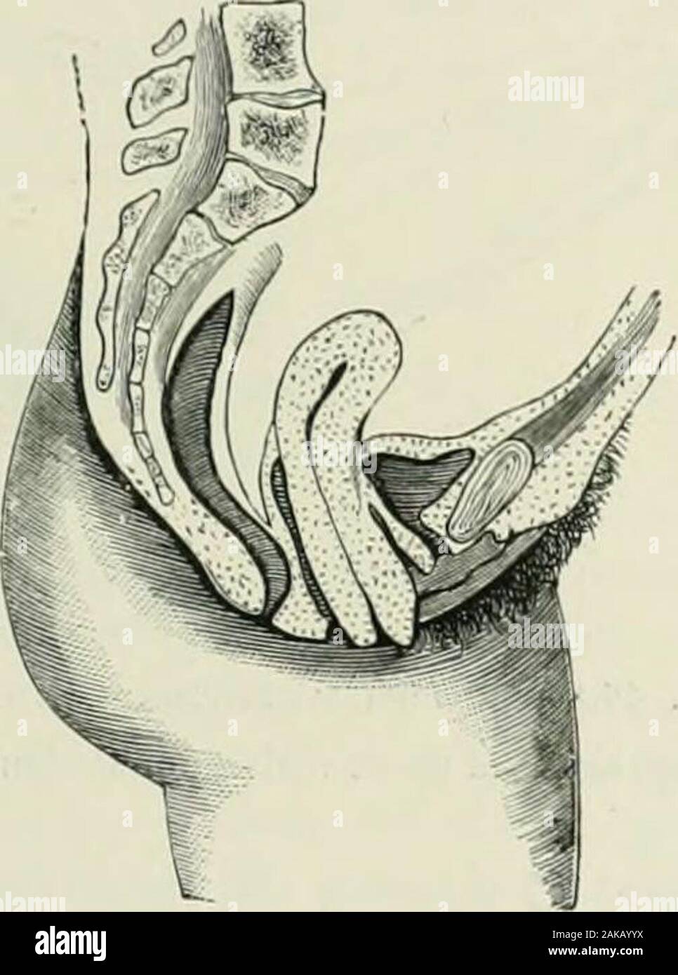 Gynecological diagnosis and pathology . simply secretesmucus, while that of the body of the uterus forms a decidua. In HYPKKTUOPIIY OF THE CERVIX 57 pregnancy, as in menstruation, the cervix plays a passive rdle, taking nopart in the active changes which the uterine mucosa undergoes. ? Pathologically, the cervix differs from the body of the uterus, forthose tumours which arc frequent in the body arc rare in the cervix, andvice versa. f connective-tissue tumours, the simple fibroma and themalignant sarcoma arc more frequent in the body; while of epithelialtumours, the simple mucous polypus and Stock Photo