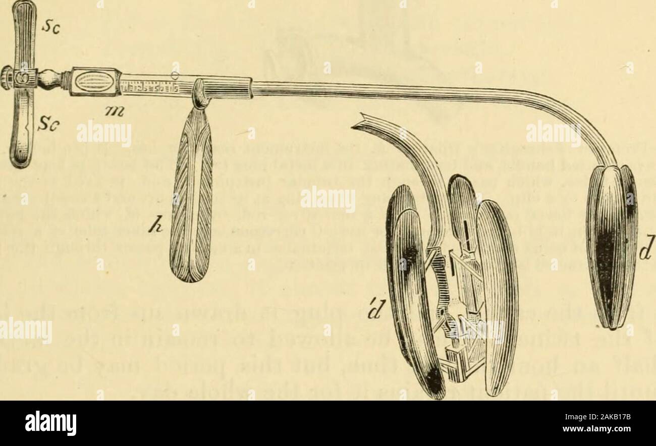 Philomic Instrument A manual of diseases of the throat and nose : including the pharynx ...