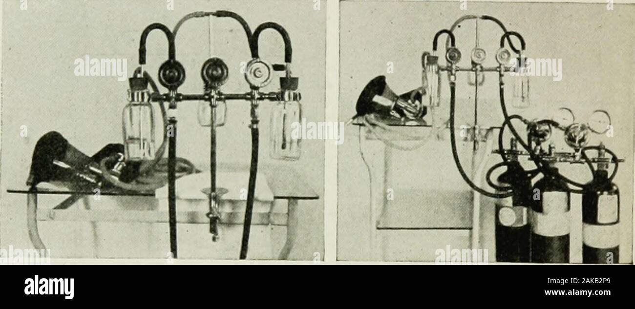 The Art Of Anaesthesia Pend Upon Theuse Of Morphine The Preparation Of The Patient The Natureof The Operation The Amount Of Ether Used And The Degreeto Which Rebreathing Is Carried Hysteria Use