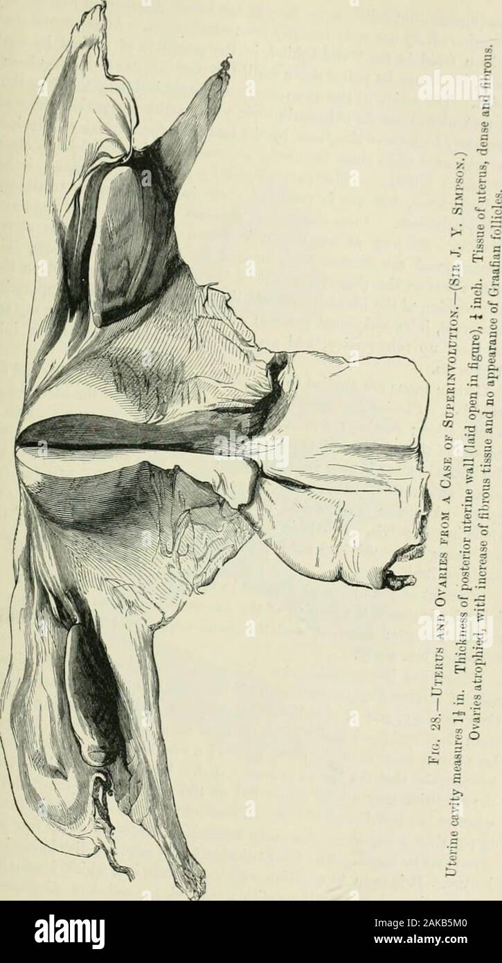Gynecological Diagnosis And Pathology Result Of A Balance Of