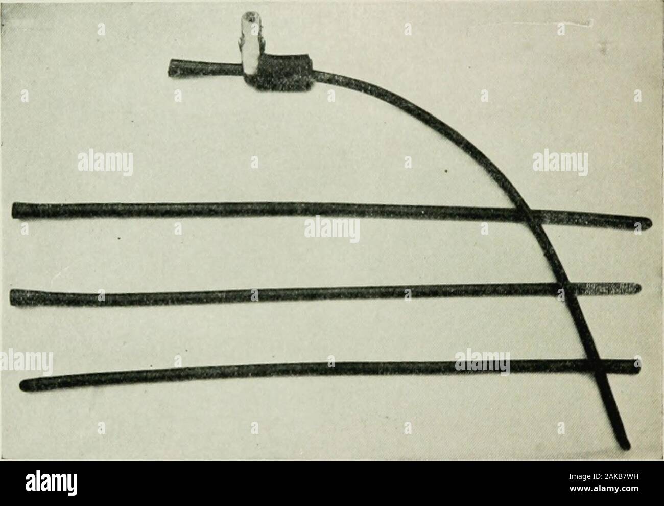 urethral catheter sizes