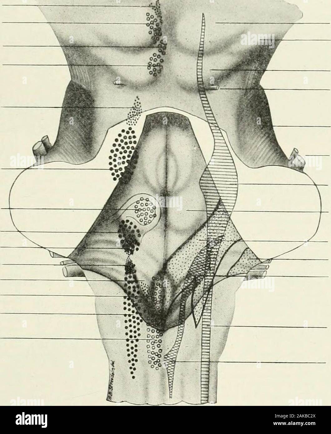 A reference handbook of the medical sciences, embracing the entire range of scientific and practical medicine and allied science . the meta-pore or foramen of Magendie, by which the cavity ofthe ventricle communicates with the subarachnoid of figures from tlie older authors and has added manynew figures (vol. ii., Taf. llo, M&gt;, 40) illustrative of thegreat variability of these structures. Fig. 90.) illu.s-tratcs .some fi-atures of the superficial anatomy of thisregion, upon which the underlying nuclei of the cere-bral nerves have been projected. The motor nucleiare shown on the left and the Stock Photo