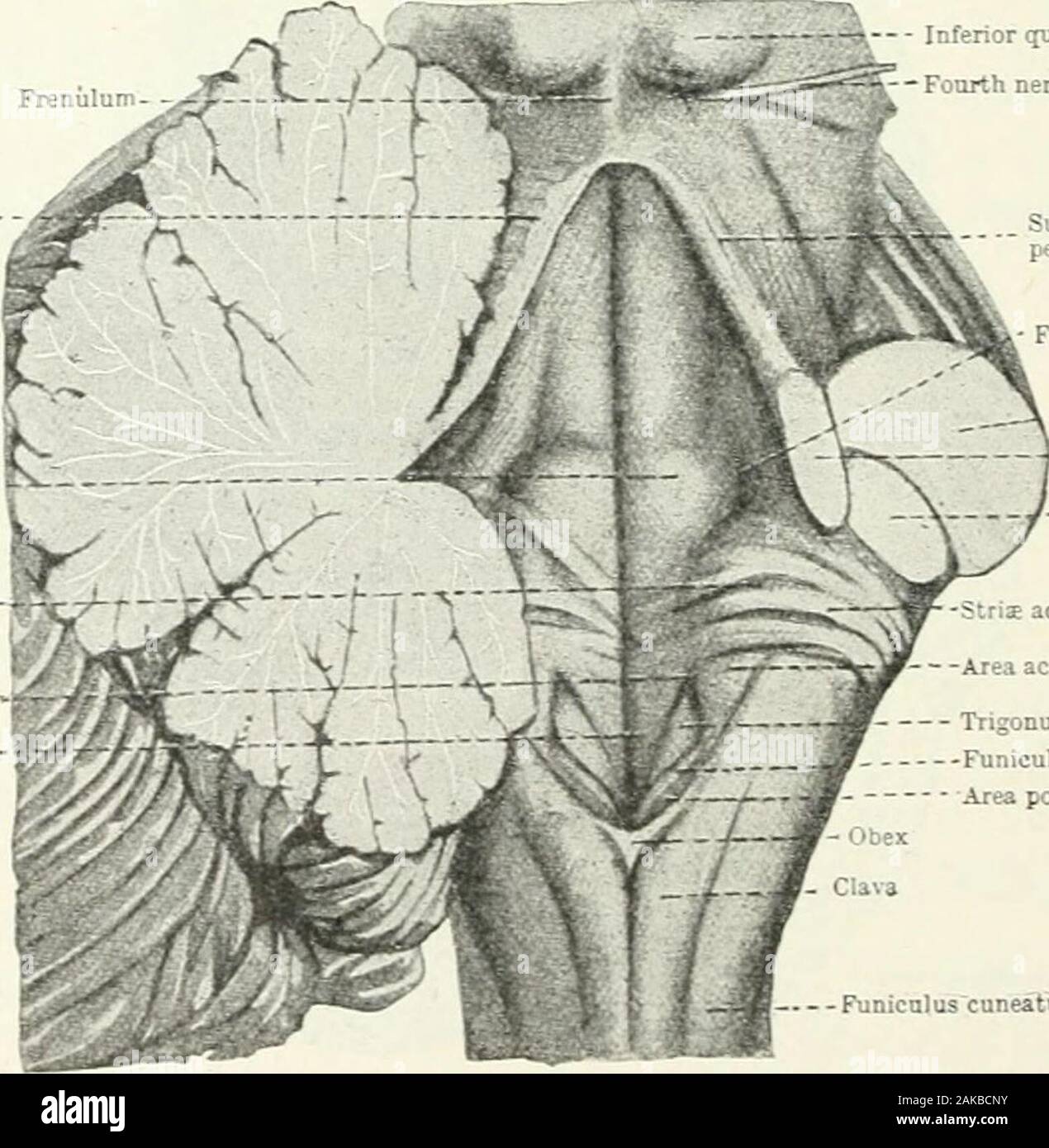 A reference handbook of the medical sciences, embracing the entire range of scientific and practical medicine and allied science . ticacrossed by strise-acusticffi. Fovea inferior- Trigonum,bypoglossi Metaplexus Postcere^ bellar arterj Vertebral artery Fig. 904-—The Metapore (Foramen of Magendie) and AdjacentParts. The left tonsilla of the cerebelliun has been removed toexpose the underlying parts. Cf, Fig. 141. /, Velum medullareposterius; //, lateral recess of the fourth ventricle; ///, flocculus;IV, plexus chorioideus lateralis; VII, VIII, IX, cerebral nerves.(After Henle and Wilder.) the c Stock Photo