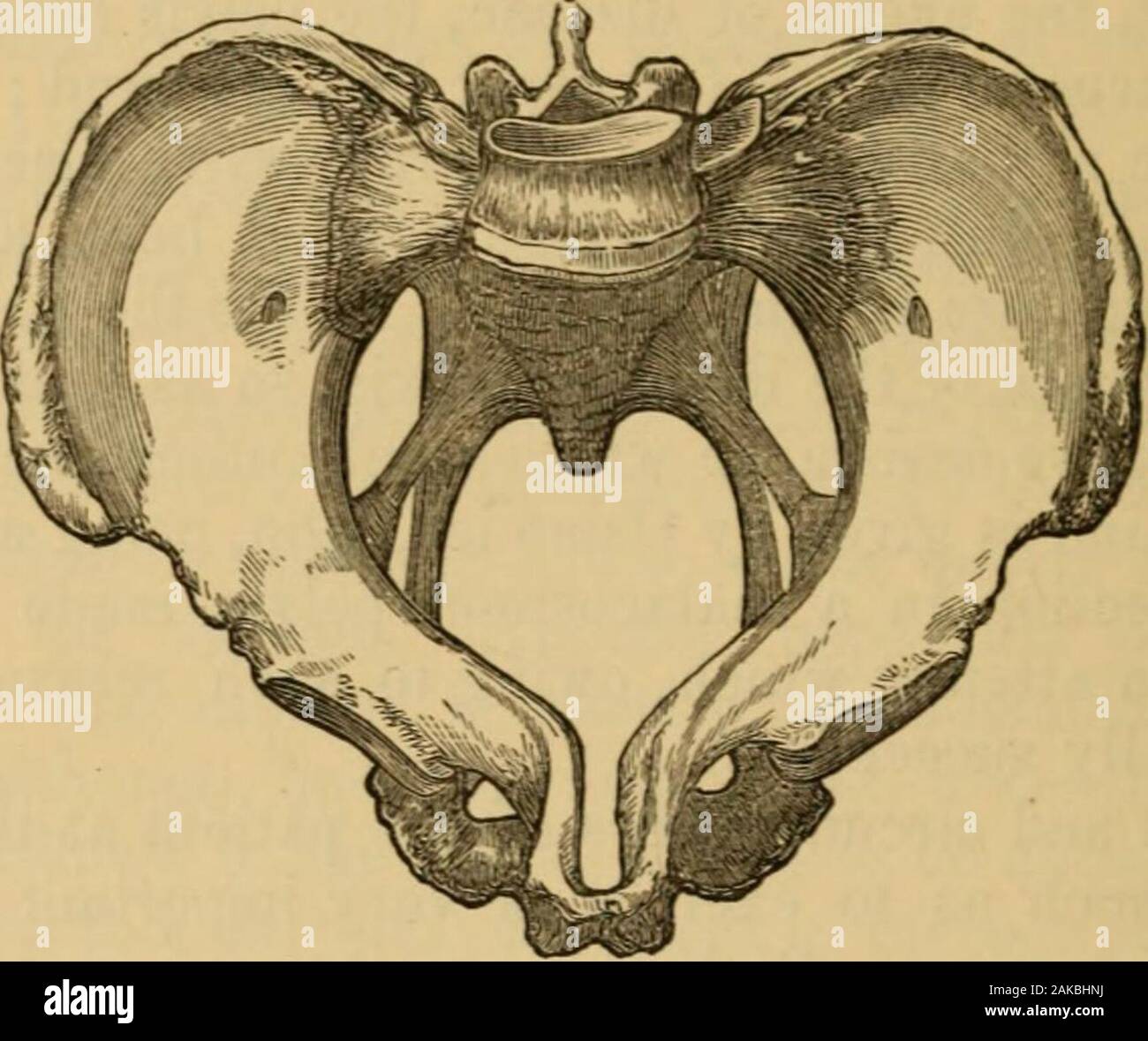 A System of midwifery : including the diseases of pregnancy and the puerperal state . Rachitic pelvis. weight of the whole trunk is thus transmitted to the heads of the thigh-bones. This difference in the nature of the forces or mechanism ofpelvic deformity Is well shown in the characteristic features of rachitican 1 malacosteon pelves. In a typical case of the former variety thereis, a- shown in Fig. L88, a marked projection forwards of the sacrumby the operation of the cause above alluded to This i- by far the mostfrequent of all the varieties of deformity which have been described.It may (a Stock Photo