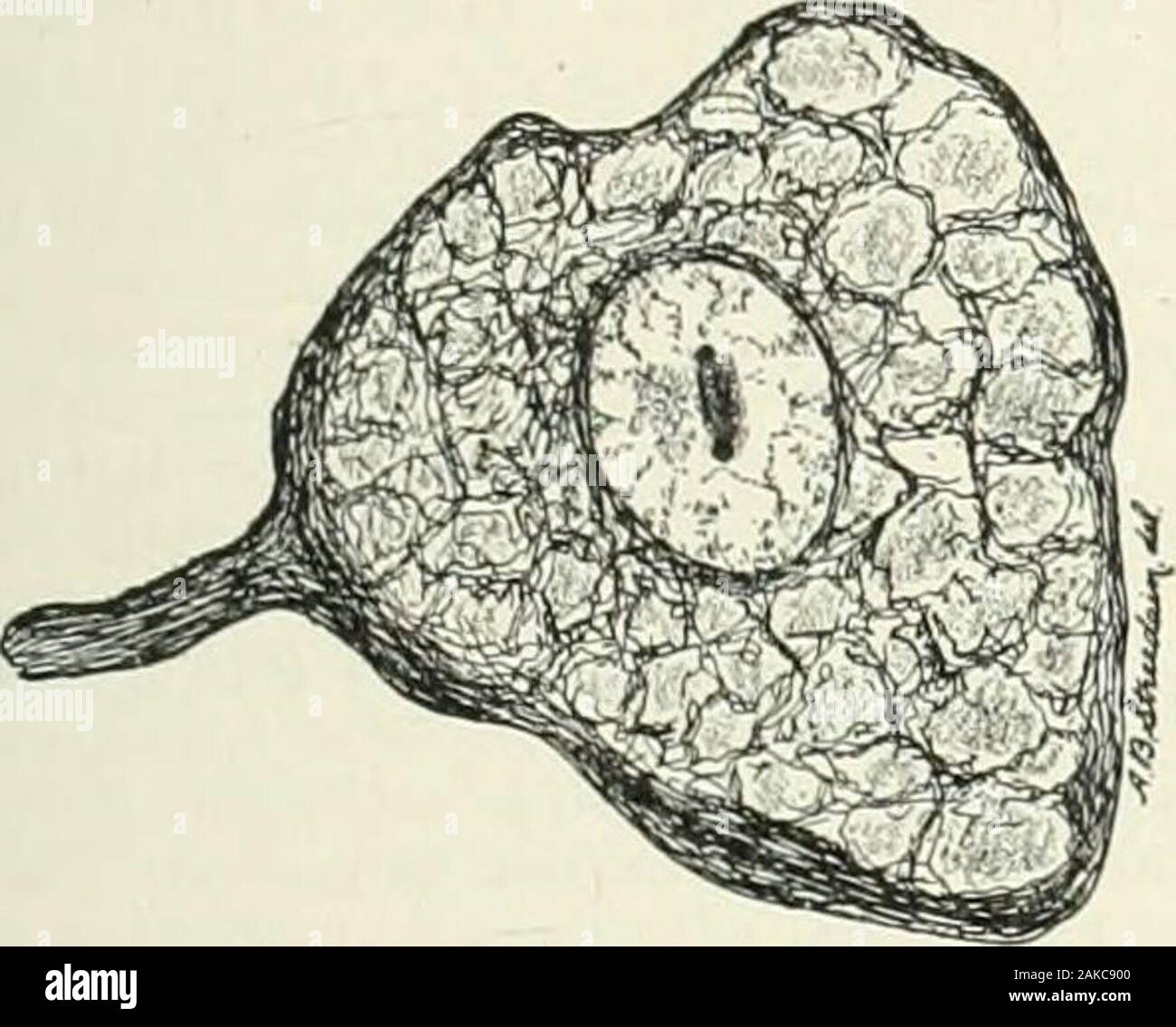 Ganglion cell hi-res stock photography and images - Alamy