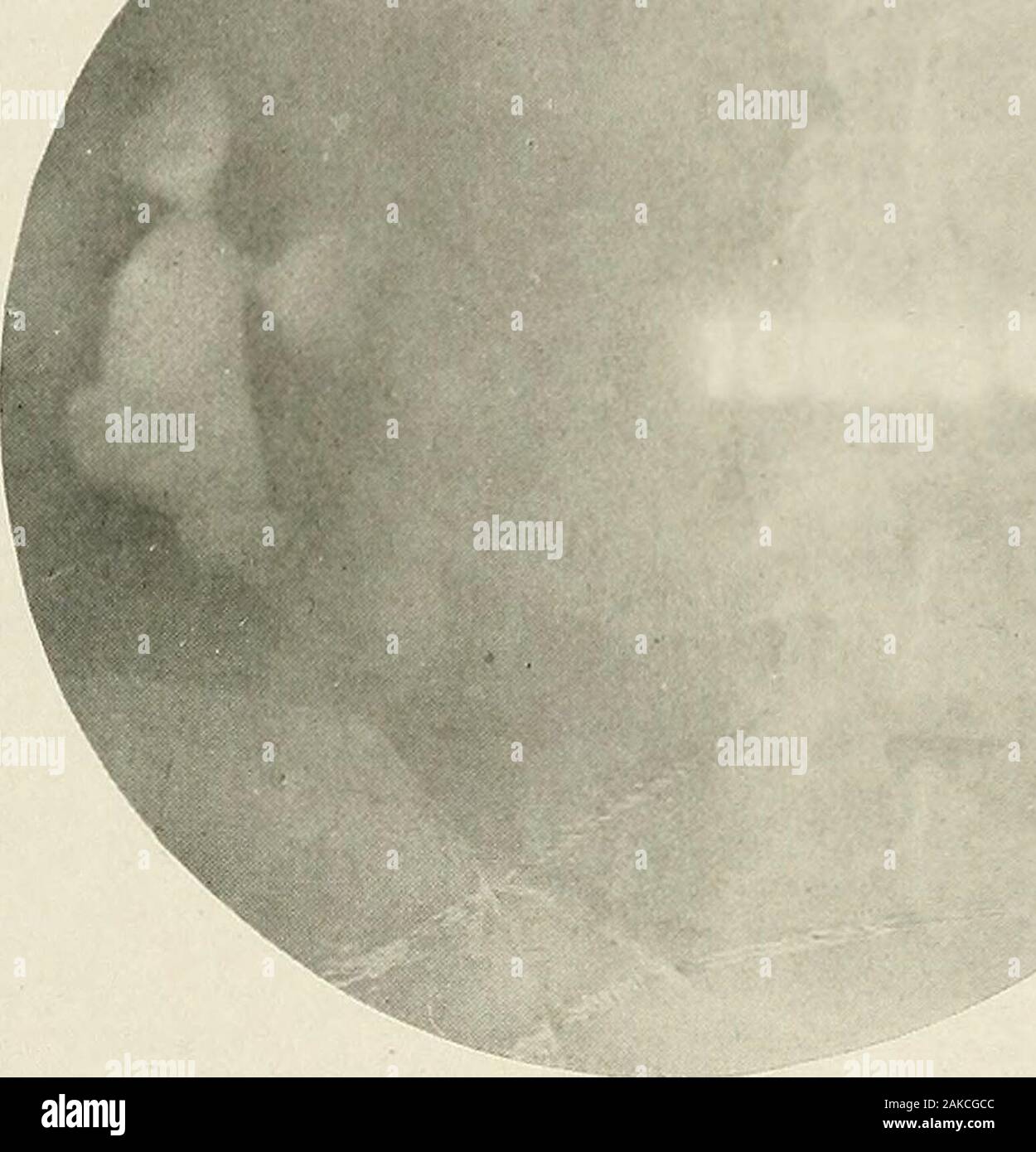 Pyelography (pyelo-ureterography) a study of the normal and pathologic ...