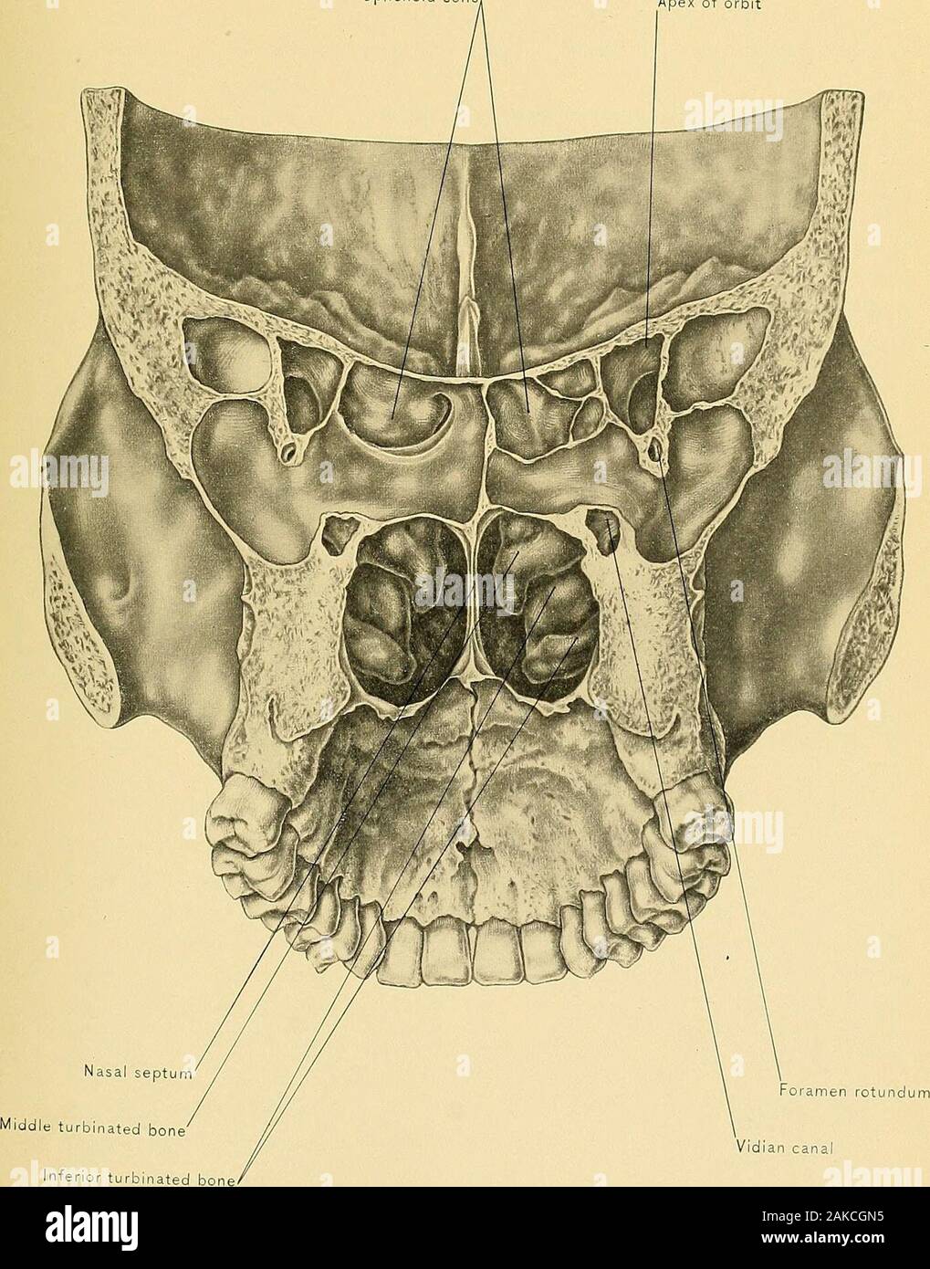 Surgical anatomy : a treatise on human anatomy in its application to the practice of medicine and surgery . with a probe search for the orifices of the sphenoid sinus and poste-rior ethmoid cells; remove the anterior portion of the middle turbinated bone, tofind the orifices of the antrum of Highmore, anterior ethmoid cells, and the in-fundibulum, and cut away the anterior portion of the inferior turbinated bone to seethe inferior opening of the lacrymo-nasal duct. The frontal and sphenoid sinuseshave been opened in sawing through the skull, so they can be satisfactorily studied. The frontal s Stock Photo