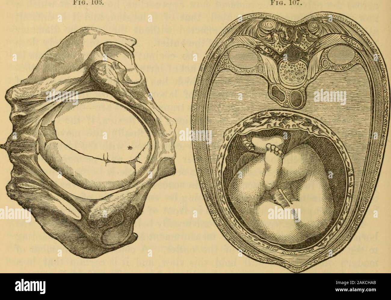 A System of midwifery : including the diseases of pregnancy and the puerperal state . havehut too faithfully copied. For these obliquities are of comparativelytrifling importance, and should never have been bracketed with theother and really important movements. Until he has fully masteredthe latter, we should ad is€ the student to take no note of these obliqui-ties. The mosi recent writers on the subject (Kiineke, Hodge, and Duncan) all dispute the conclusions of Naegele and argue in favor of the parallelism, or, as they term it, Synclitism, of the biparietal and cervico-bregmatic plane- of Stock Photo