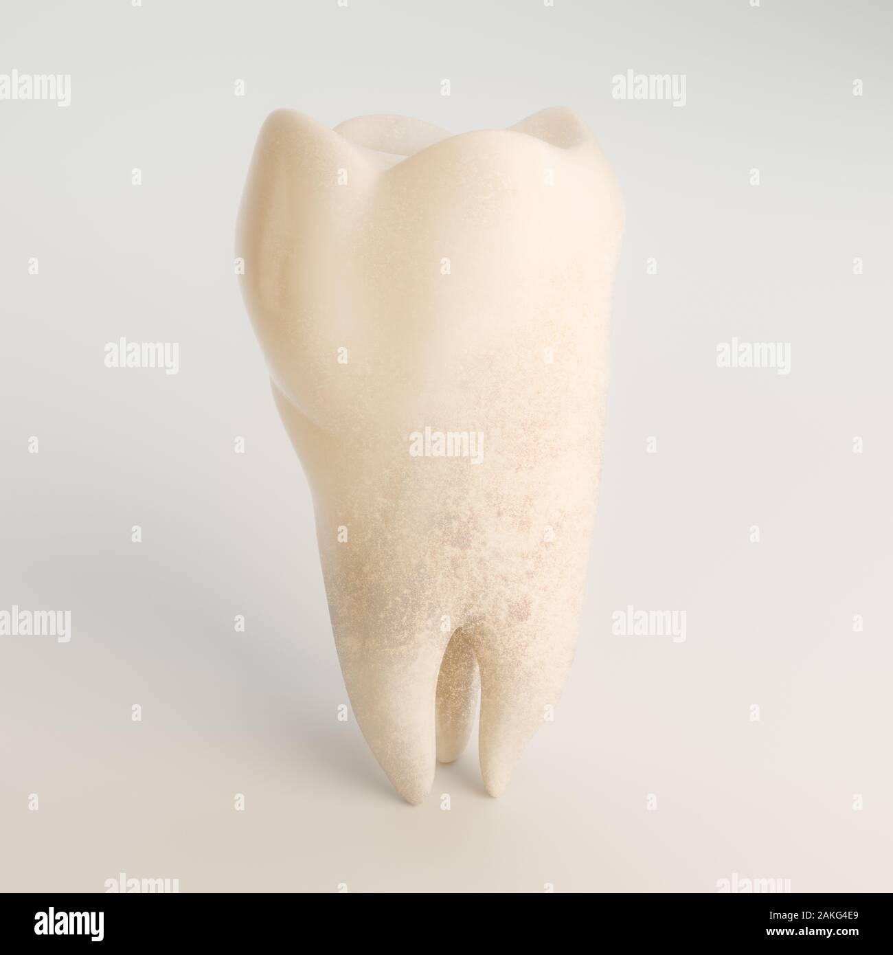 Jaw tooth with tooth discoloration and tartar - 3D Rendering Stock Photo
