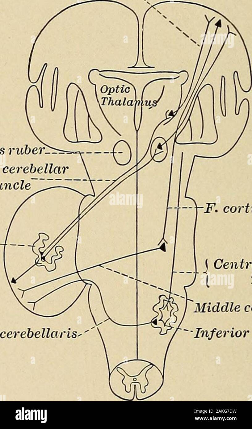 Diseases of the nervous system : a text-book of neurology and psychiatry . bellar tract lies on the medial side of the inferiorcerebellar peduncle, in the medial lateral portion from the superiorcerebellar peduncle, in which a portion also goes. The majority ofthe bundles go to the cerebellar worm and end, mostly crossed, in the 228 SENSORI-MOTOR NEUROLOGY ^CRANIAL NERVES nuclei of the roof (tectalis), probably also in the nucleus globosus andnucleus emboliformis. Within the superior cerebellar peduncle portions it may be saidthat, according to Bechterew and Flechsig, the Bechterew nucleiare c Stock Photo