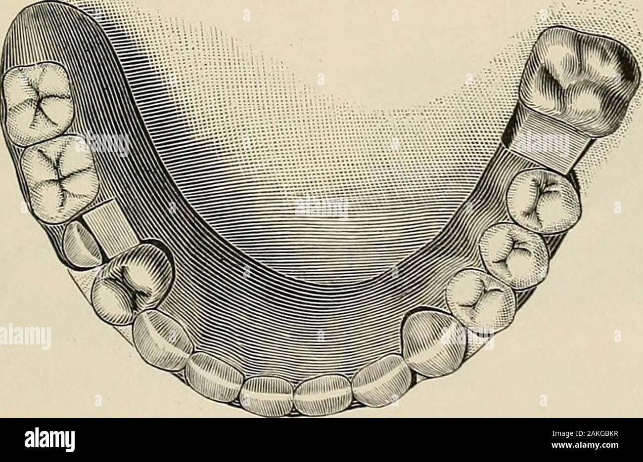 Page 3 Dentis High Resolution Stock Photography And Images Alamy Page 3 Dentis High Resolution Stock Photography And Images Alamy