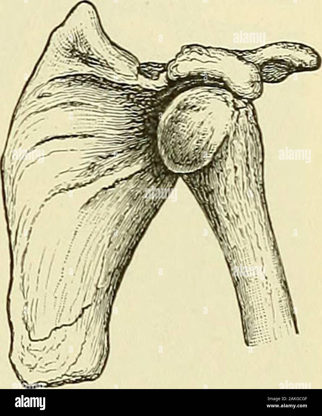 A manual of modern surgery : an exposition of the accepted doctrines and approved operative procedures of the present time, for the use of students and practitioners . on of this bone themost common of dislocations. A7iolent muscular contraction of epi-leptic and similar convulsions may cause the lesion. The capsuleusually tears at its lower part, which is the weakest. The head of thehumerus usually goes either forward or backward. Its final locationdepends upon the nature and direction of the force, and upon secondarymovements of the bone. Occasionally the head is displaced directlydownwards, Stock Photo