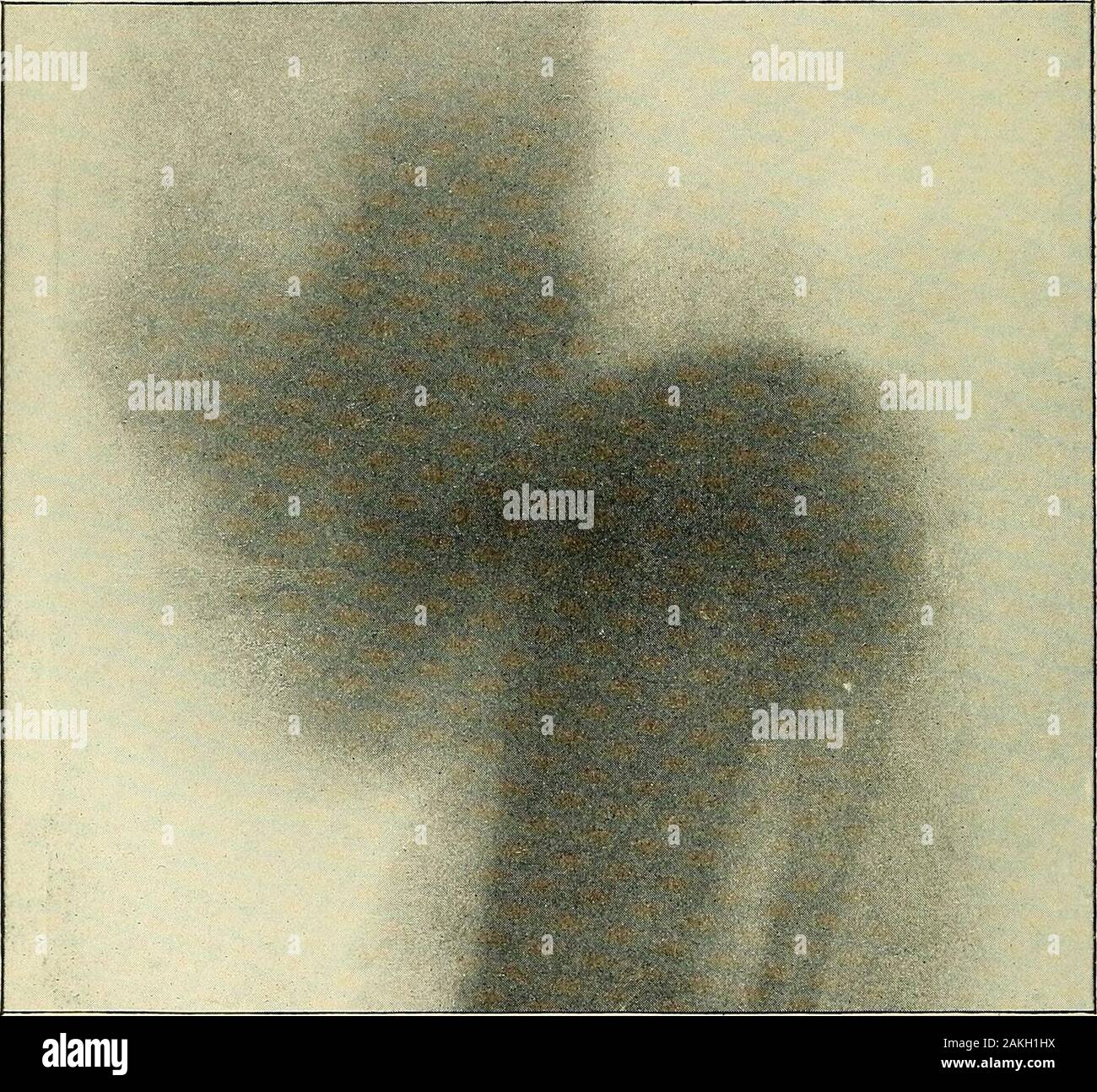 Hysterical affections hi-res stock photography and images - Alamy