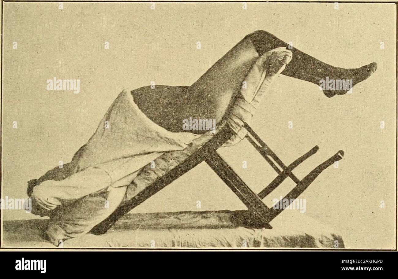 A nurse's handbook of obstetrics, for use in trainingschools . Fig