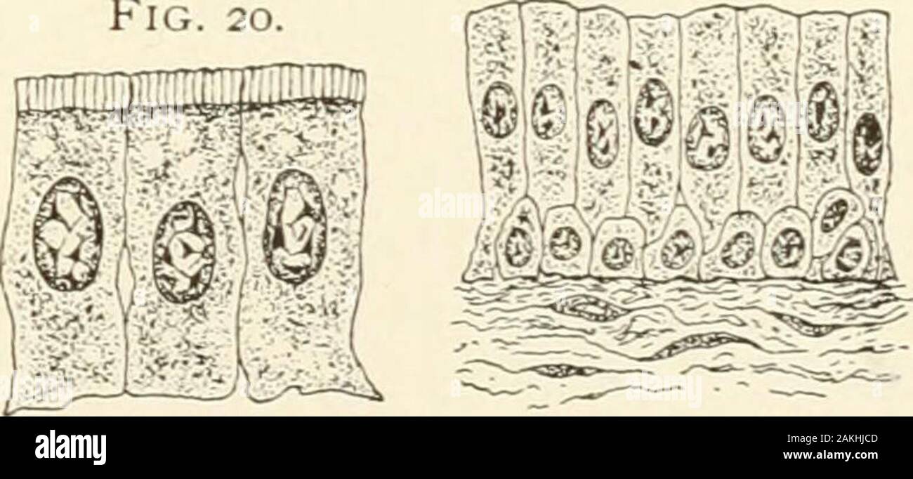 Simple Squamous Without Label Simple Squamous High Resolution Stock Photography and Images - Alamy