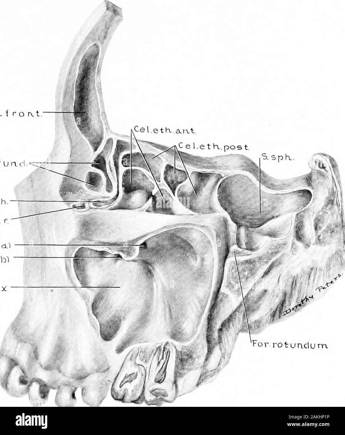 Development and anatomy of the nasal accessory sinuses in man