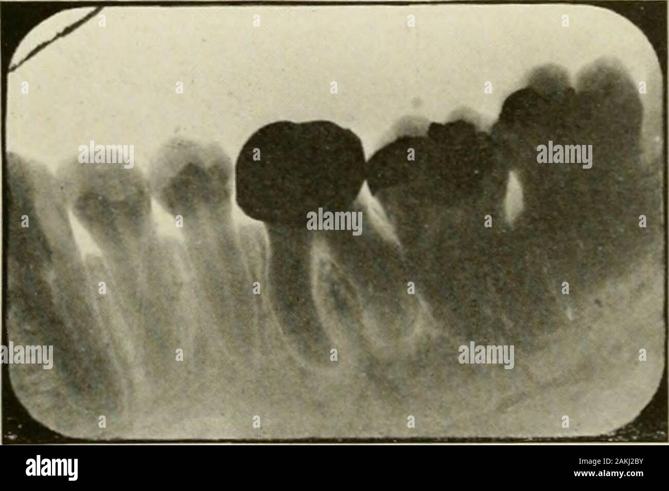 General and dental pathology with special reference to etiology and
