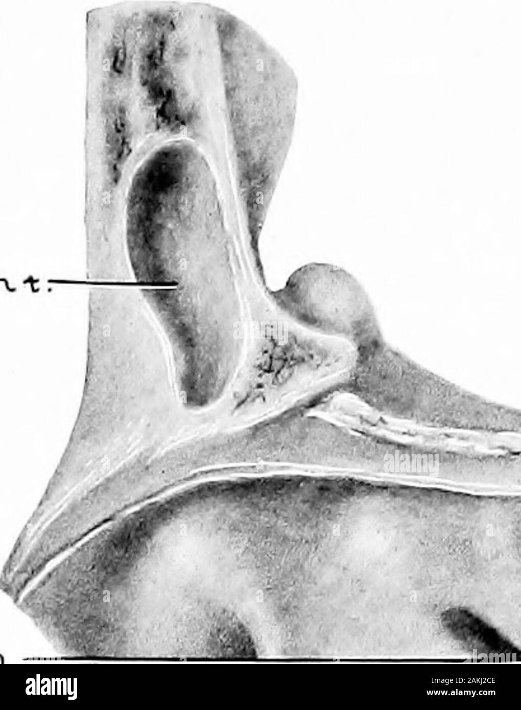 Development And Anatomy Of The Nasal Accessory Sinuses In Man Observations Based On Two Hundred And Ninety Lateral Nasal Walls Showing The Various Stages And Types Of Development Of The Accessory Sinus