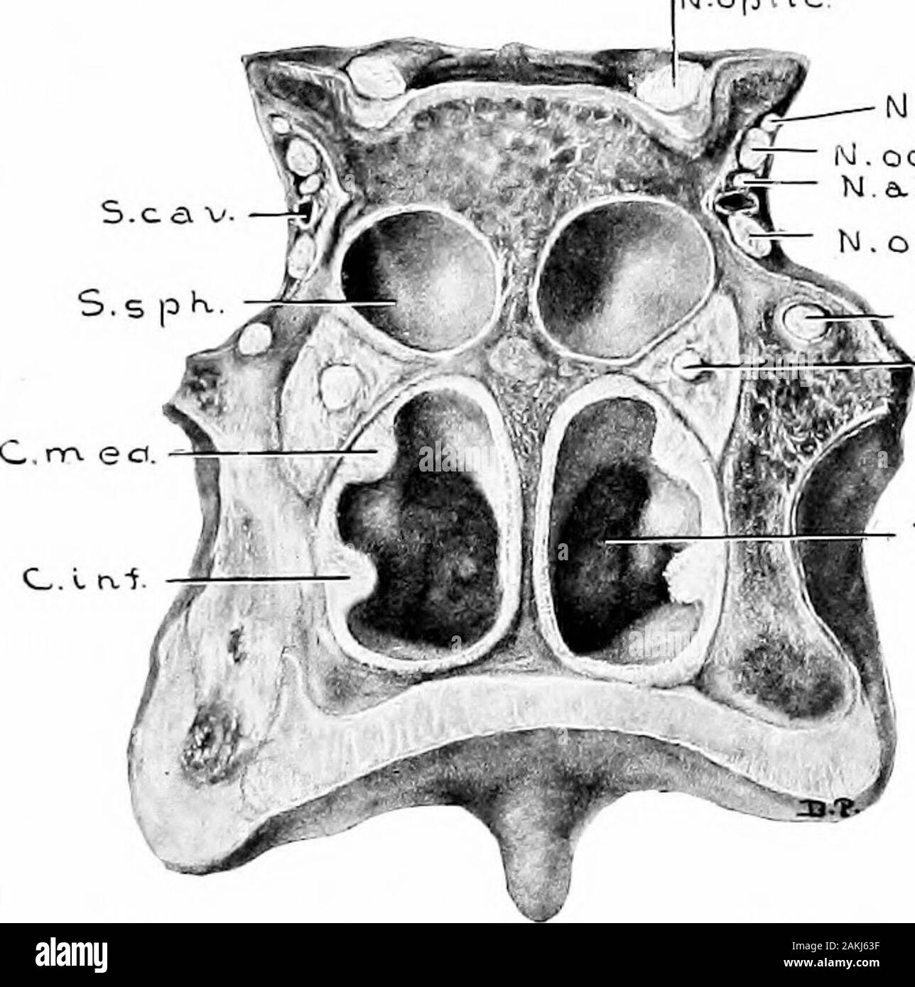 Development and anatomy of the nasal accessory sinuses in man; observations based on two hundred and ninety lateral nasal walls, showing the various stages and types of development of the accessory sinus areas from the sixtieth day of fetal life to advanced maturity . Ton-.pKa.r. Fi(i. 31.—Specimen From a Child Six Years, Ten Months, and TwentyDays Old. L.^teeal View of This Specimen is Shown in Fig. 30.(Series D, No. 53.) Sagittal section li mm. to the left of median line, showing extent of sinussphenoidalis and also the relation of the structures entering into the formationof the septum nasi Stock Photo