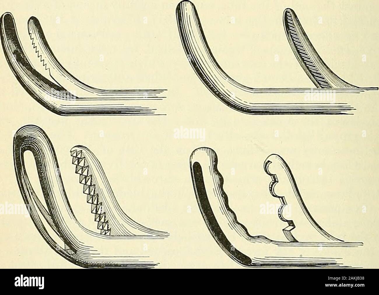 An American text-book of genito-urinary diseases, syphilis and diseases of the skin . Fig. 141.—Thompsons lithotrite. motion of the blades, and also employed a fenestrated blade to clear the jawsof the debris, so that the withdrawal of the instrument was obviated (Fig.141). The jaw of the male blade was variously modified by roughening it,. Fig. 142.—Some modifications of the lithotrite blades. furnishing it with teeth, projections, etc., all designed to improve the grasp-ing power on the stone. In 1878 there came another important change in the lithotrite, by which Stock Photo