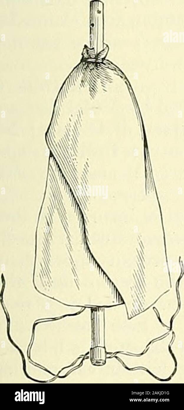 An American text-book of genito-urinary diseases, syphilis and diseases of the skin . tself against the pubic arch ; this carries the bulb up out of reach of theknife, and it will rarely be wounded if this precaution is observed. Hemor-rhage, which may be severe, arises ordinarily from the artery of the bulb or theanterior portion of the venous plexus around the prostate, or in the form of ageneral oozing from the cut surfaces of the gland; the latter is usually unim-portant. The source of the bleeding should be carefully sought, and all arte-rial branches should be tied; the venous bleeding a Stock Photo