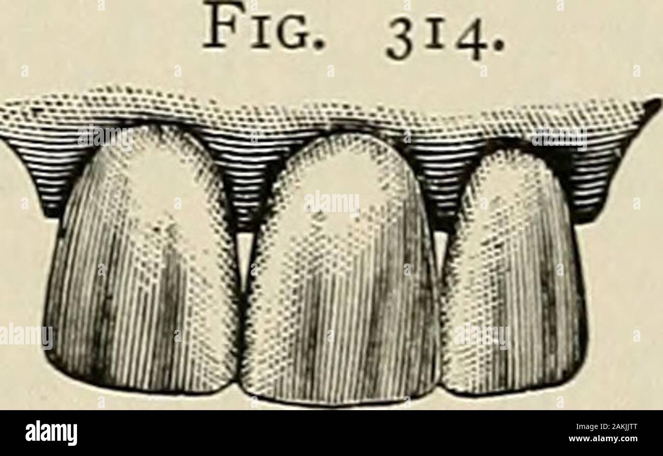 A practical treatise on mechanical dentistry . Fig. 315. Stock Photo