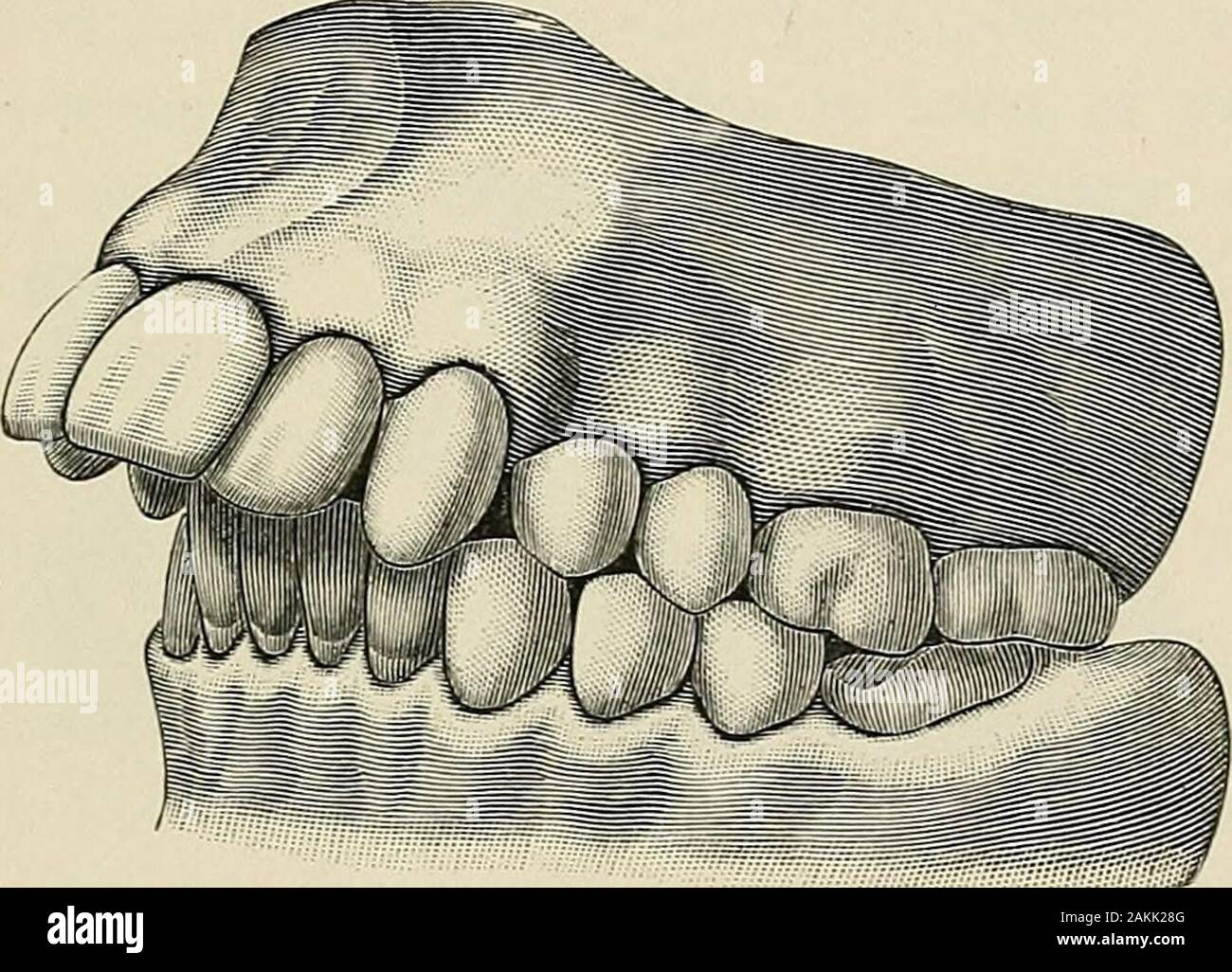 A practical treatise on mechanical dentistry . as not until Dr. Calvin