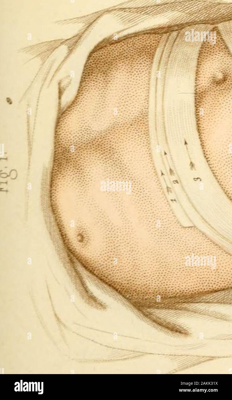 [Manual of surgical bandages, devices and dressings . Stock Photo
