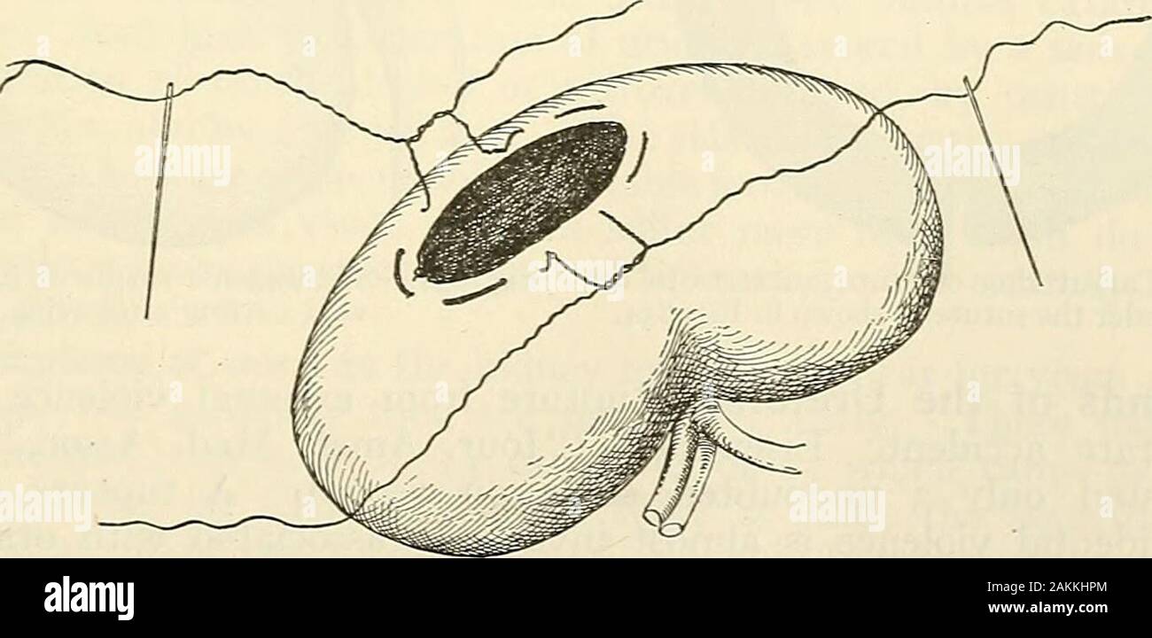 Schacher hires stock photography and images Alamy