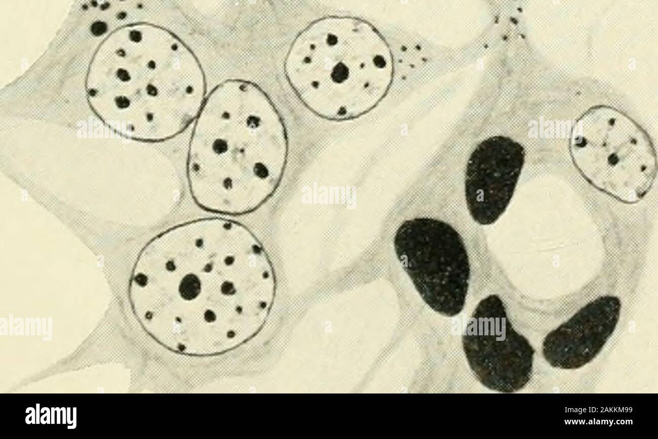 The American journal of anatomy . .V .T^-X •:^ Lumen ,•••. •:•• / •  / THE AMBBICAN JOURNAL OF ANATOMY, VOL. 12, NO. 3 271 PLATE 2 EXPLANATION OF FKiURES 5 Cyst invaginated by a vascular pial trabecula, forming a glomerulus from15 cm. stage of development. X 1500. 6 Photomicrograph of peripheral portion of pineal body of 21 cm. stage, show-ing several cysts and several vascular trabeculae, and the presence of an enormousnumber of melanic granules. X 250. 7 Transverse section of a small alveolus or cyst, showing the character of thecells, the distribution of the melanic granules and the reticu Stock Photo