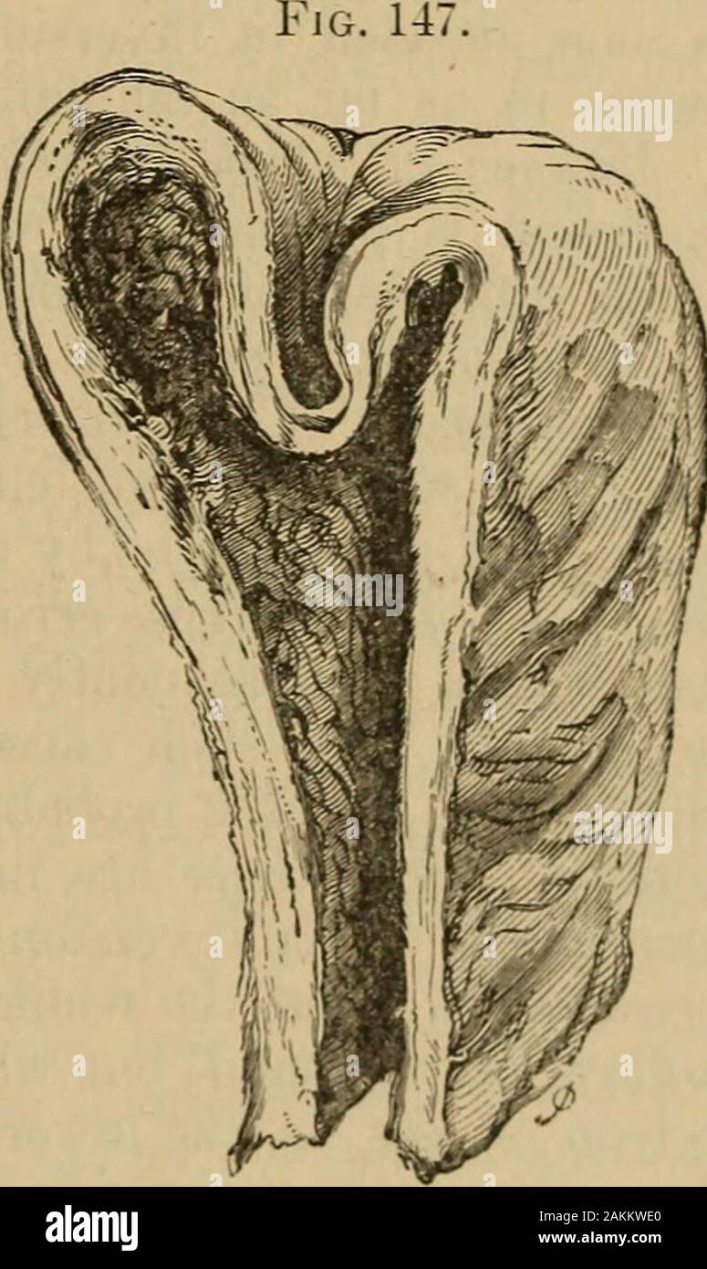 A Treatise On The Science And Practice Of Midwifery Of The Gynaecologist And Involves The Considerationof Many Points That Would Be Out Of Place In A Work On Obstetrics Here Therefore The