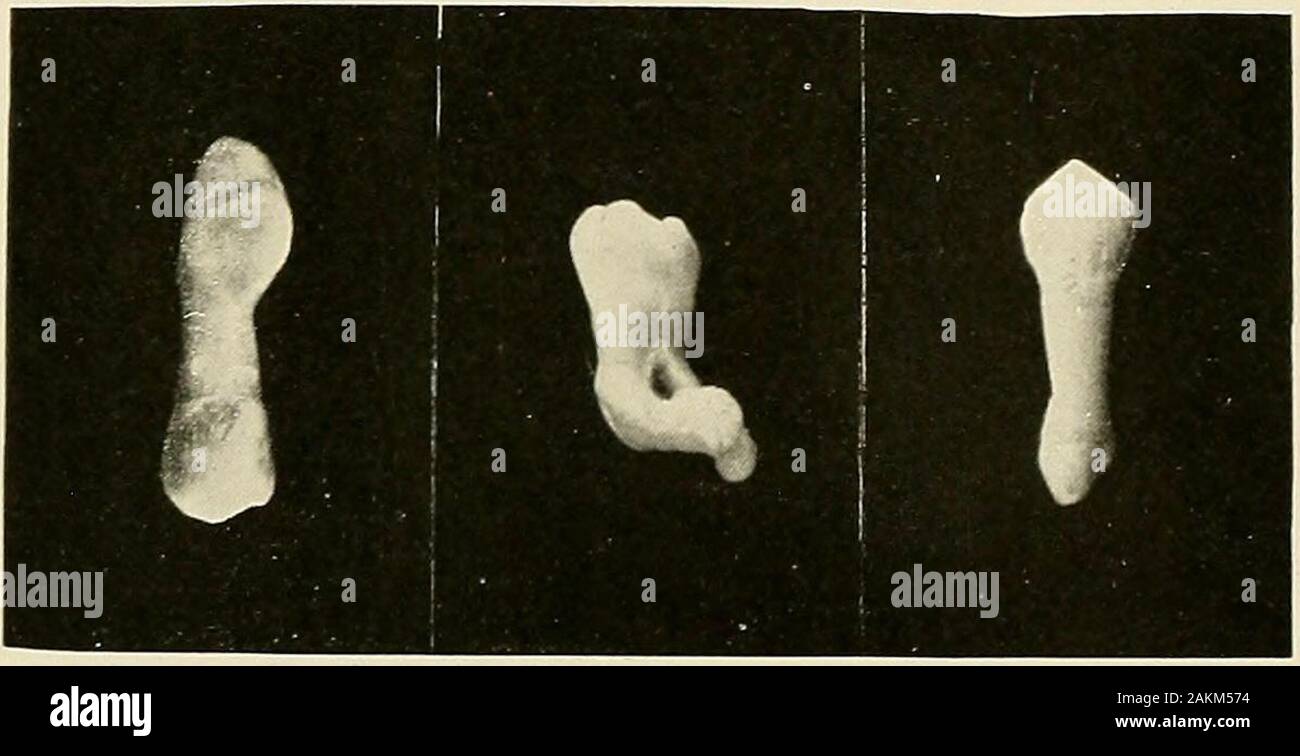 Principles and practice of operative dentistry . Fig. 603 Stock Photo