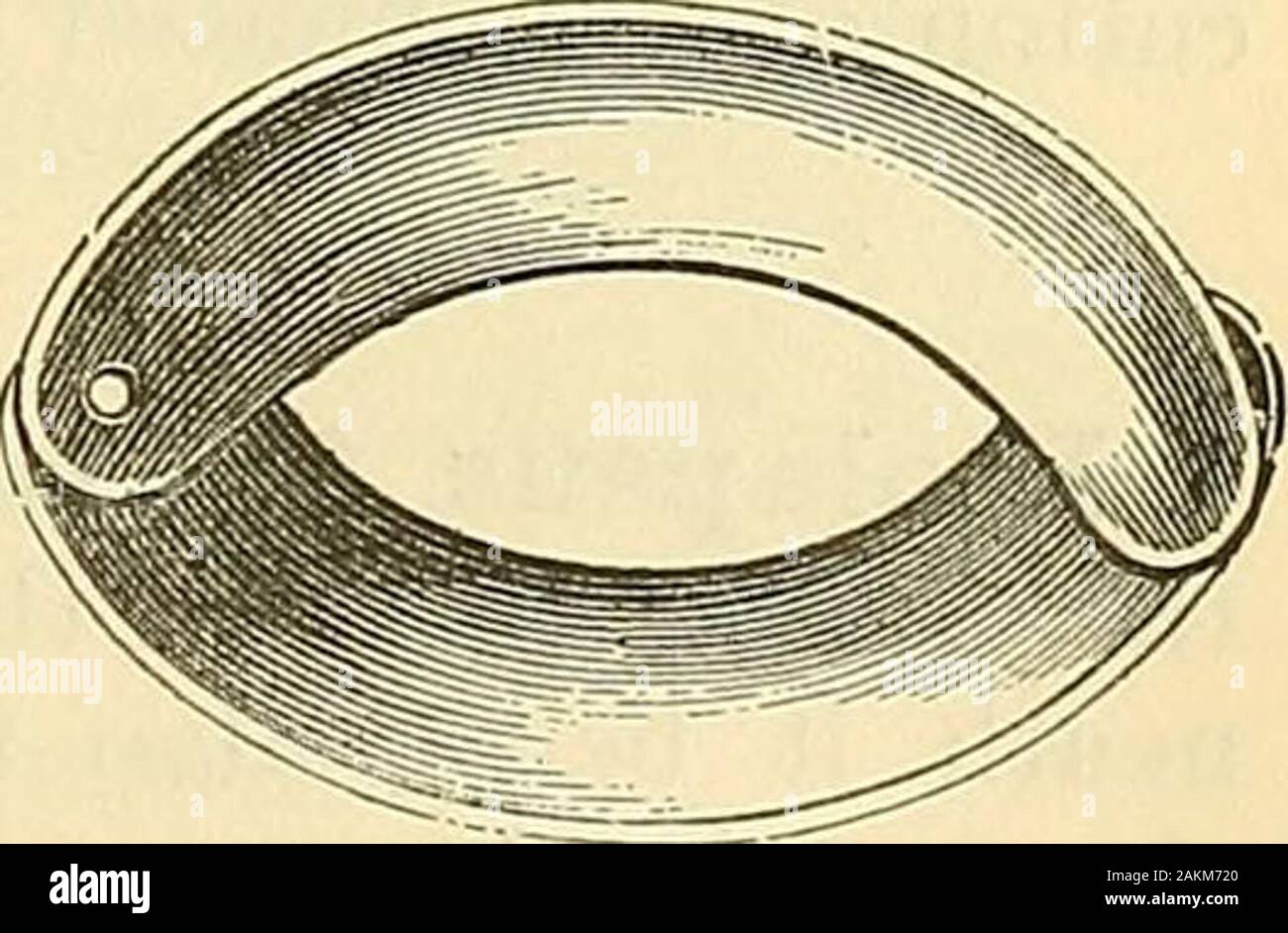 Anus piles hires stock photography and images Alamy