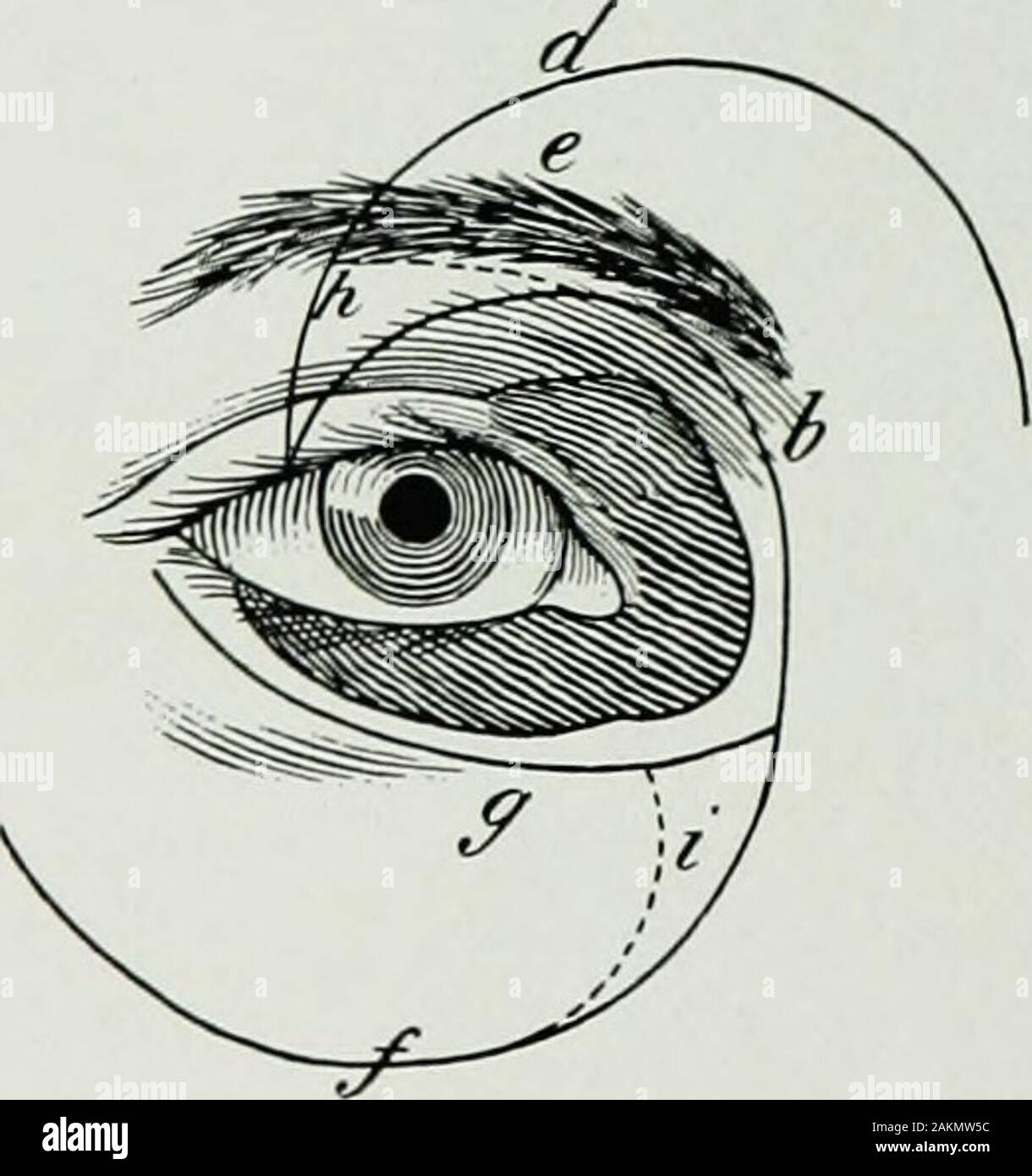 War surgery of the faceA treatise on plastic restoration after facial injury by John BRoberts ..Prepared at the suggestion of the subsection on plastic and oral surgery connected with the office of the surgeon generalIllustrated with 256 figures . Fig. 244.— Reconstruction of inner canthus by sliding flaps of upper andlower lids to close space left by excision of tumor, after removal of tumor.. Stock Photo