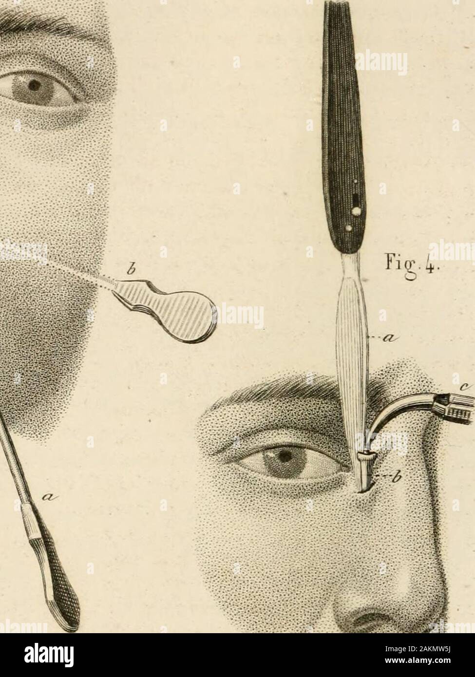 Précis iconographique de médecine opératoire et d'anatomie chirurgicale . Fi y; 2. Fur 3. Stock Photo