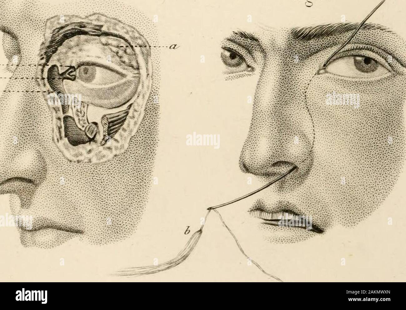 Page 8 Nasal Pharynx High Resolution Stock Photography And Images Alamy