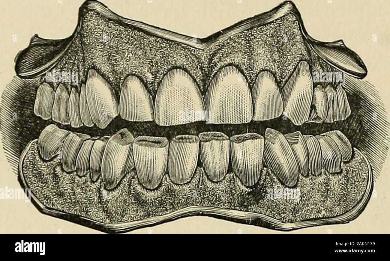 A practical treatise on mechanical dentistry . it may often be extended ...