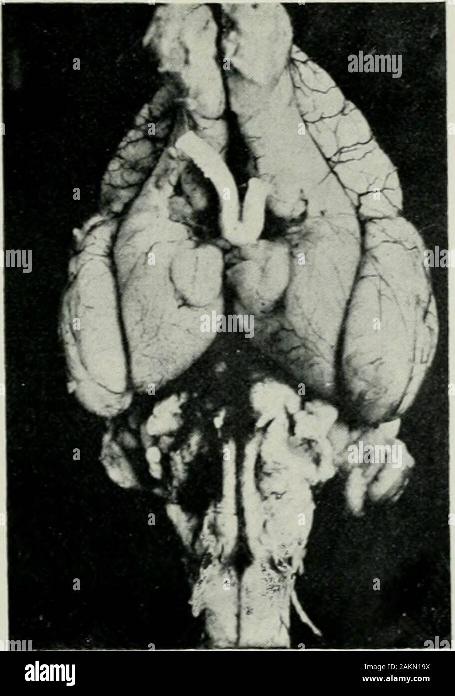 The Journal of laryngology and otology . Fig. 3.—Shot rabbit, No. 2. Single pellet fractured the right petrous bone andcaiised slight bruising of the right pontine nucleus and tract and trapezinm.Note the curvature of the trunk concavity to the right, the head turnedtowards the right, and the right ear really approximated to the rightshoulder, both fore limbs extended, homolateral hind limb flexed, contra-lateral extended. There was also present skew deviation of the eyes —righteye down and in, left up and oat.. Fig. 4. —The brain of the rabbit. No. 2, shown in Fig. 6. The only lesion of theen Stock Photo