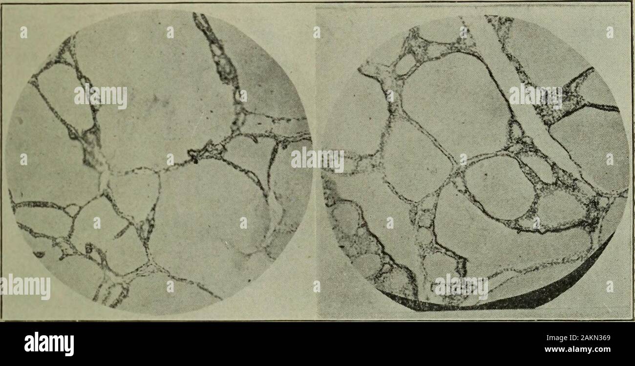 The Cleveland medical journal . Fig. T.Normal Thyroid and Parathyroid