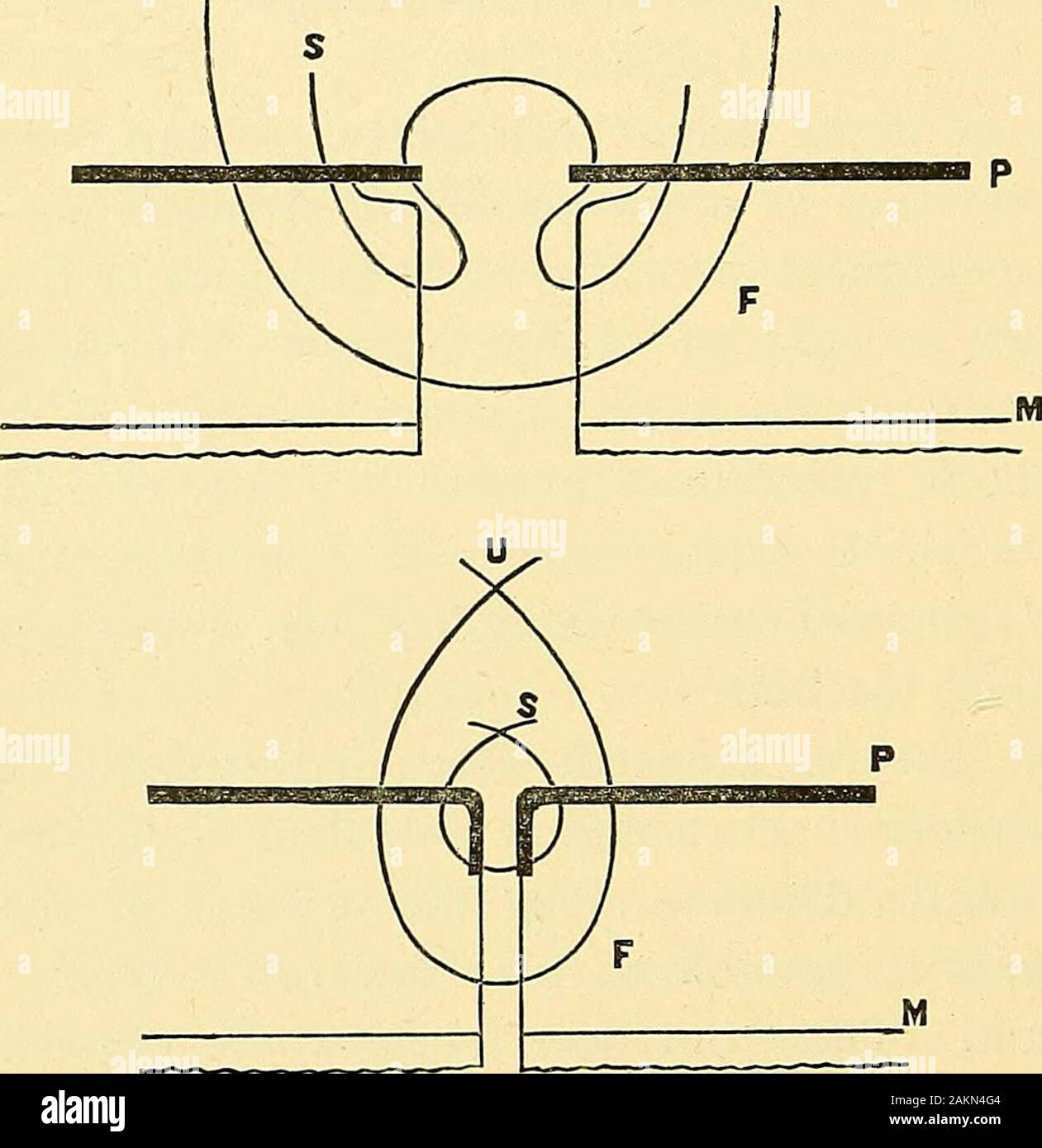 Abdominal surgery . deep sutures should be placedabout three-quarters of an  inch apart; and they should becarried, converging a little, beyond the ends  of the incision. Then the superficial sutures are placed,