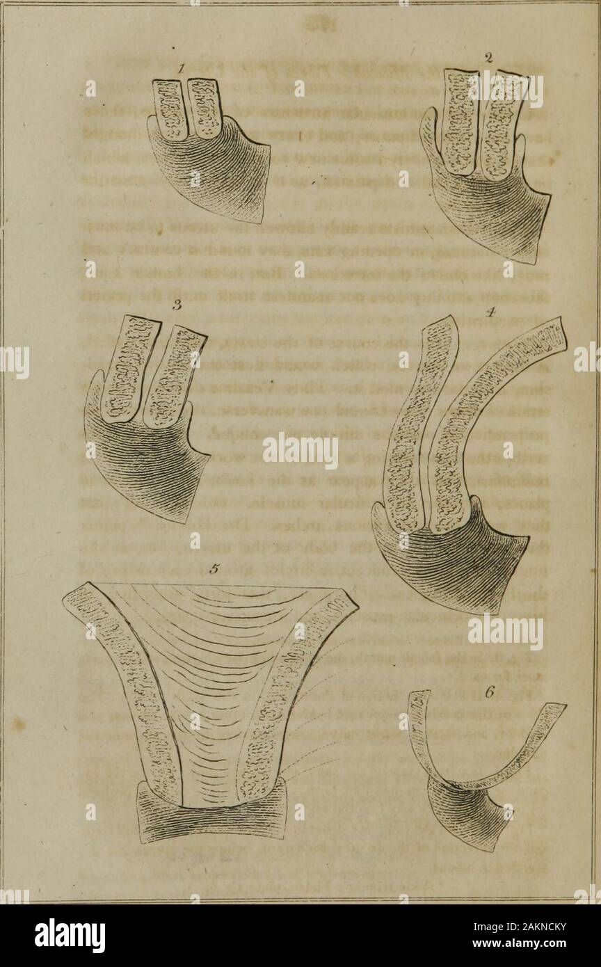 Burns's Obstetrical works : the anatomy of the gravid uterus : with practical inferences relative to pregnancy and labour : observations on abortion : containing an account of the manner in which it takes place : the causes which produce it : and the method of preventing or treating it : practical observations on the uterine hemorrhage : with remarks on the management of the placenta . we find the os ute-ri more or less open, tense during pain, but thick, soft, and as if chopt,during the intervals. The plane of the orifice, at this time, is nearlyparallel to that of the superior aperture of th Stock Photo