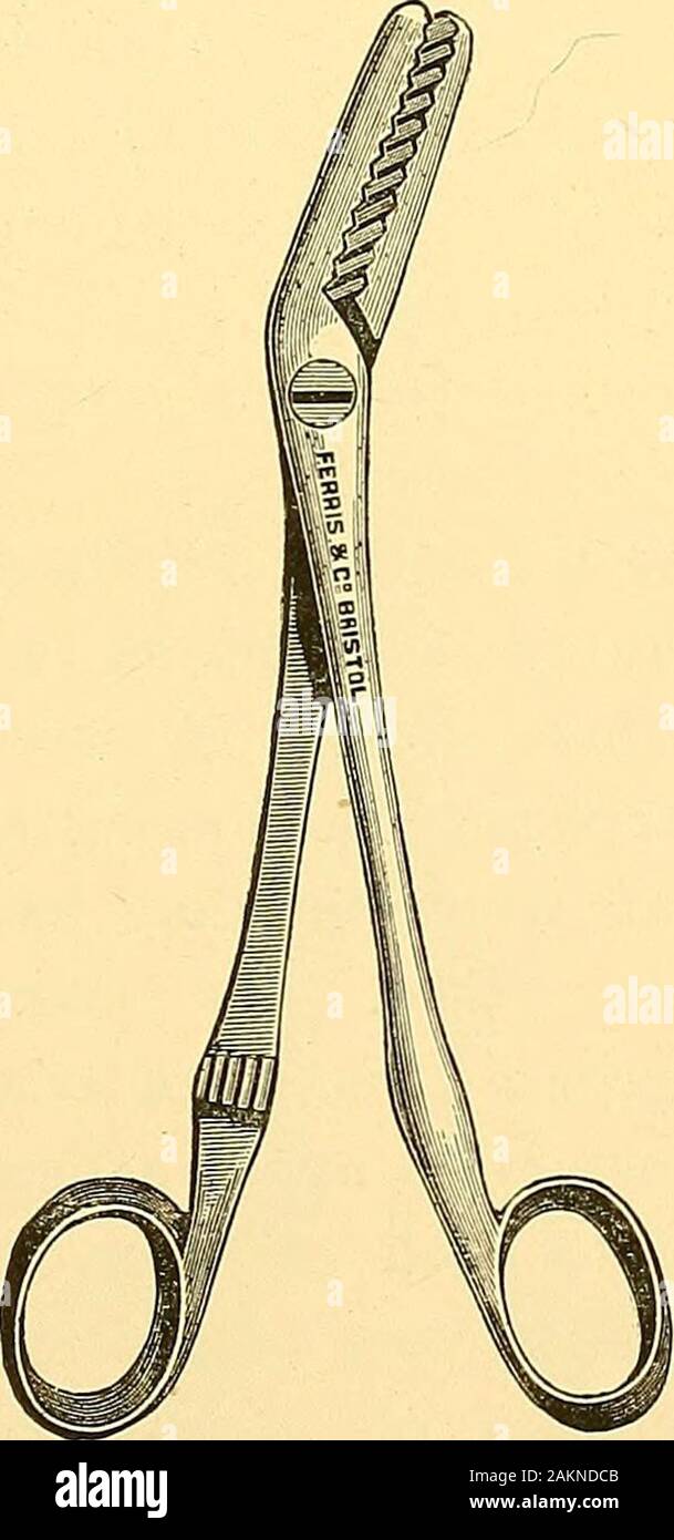 Abdominal surgery . them Adhesions of some de-gree of firmness, if broad, mustbe separated by fingers : if longor thin, or of the bulk that mightbe classed as bands, they aredivided by scissors betweenpairs of catch-forceps. Verydense, broad, and sessile adhe-sions are divided by scissors;while forceps or ligature, as mayseem most suitable, checks thebleeding as it arises. The best form of forceps foradhesions is, I think, Taitsmodification of Koeberles in- Taits modification of Koeberles CatchForceps. Two-thirds size, strument. (Fig. 6.) But Wellss in-strument is almost equally good, andsurge Stock Photo